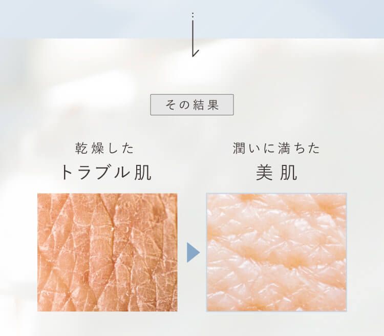 その結果潤いに満ちた肌へ