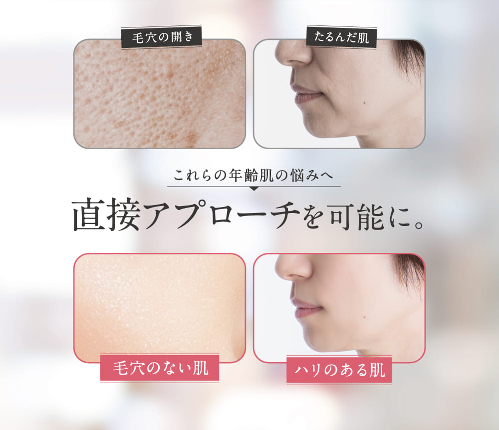 直接アプローチを可能に。
