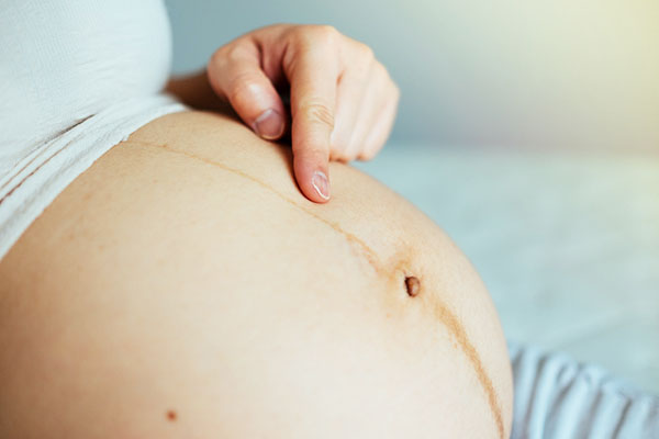 5 ヵ月 お腹 妊娠 妊娠中「お腹が出る人」と「お腹が出ない人の特徴」２人目・双子妊娠は？