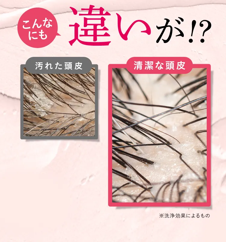 こんなにちがいが！？